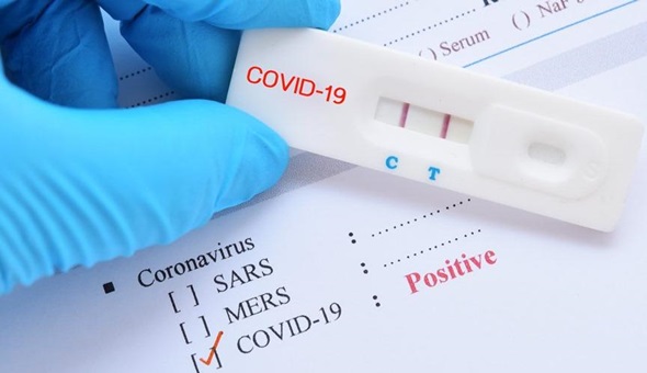 15 yaşındaki kız, 30 kişiye virüs bulaştırdı’