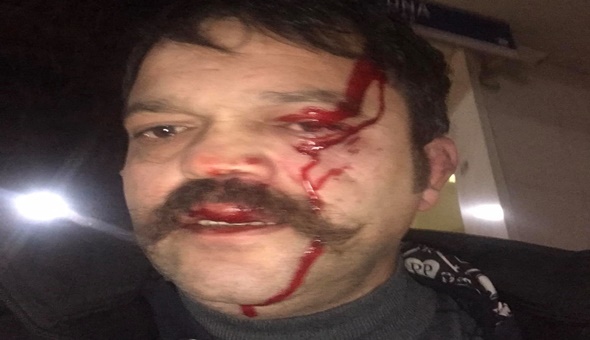 AKP’linin tecavüz davasından bahsetti, dayak yedi