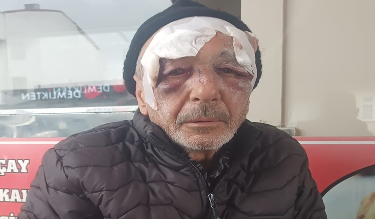 Bunun adı eşkıyalık! Yaşlı adama saldırdılar