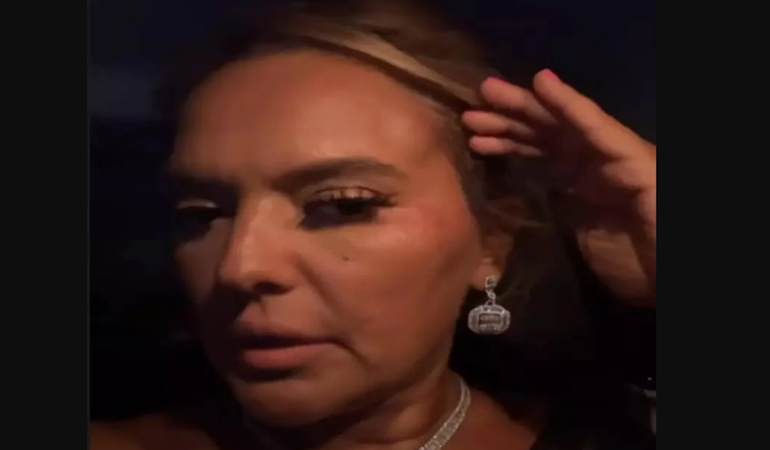 Demet Akalın konser yolunda tekne kazası geçirdi