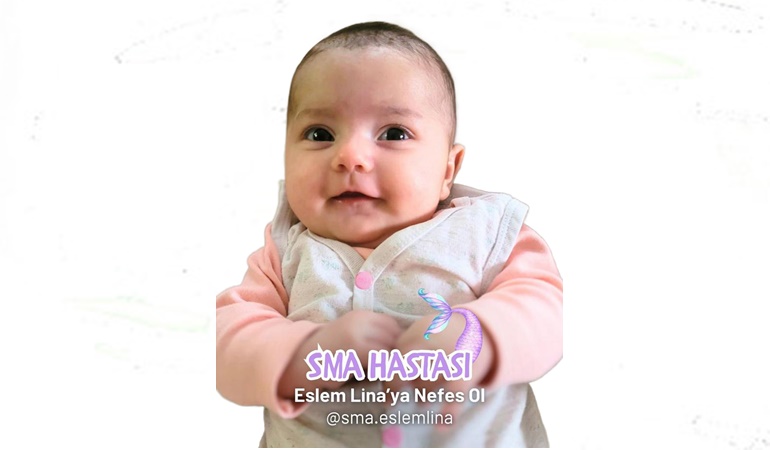 SMA’lı Elif bebek yardım bekliyor