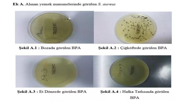 Sokaktan aldığınız bakteriler böyle görüntülendi! 