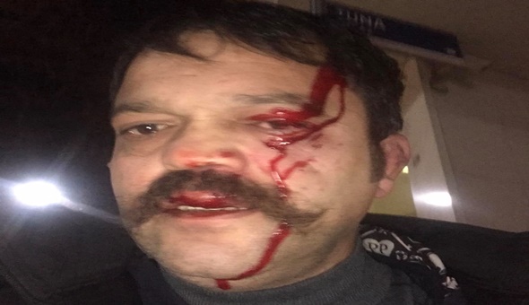 Tecavüzcü AKP’liyi kınayana saldırıda yeni gelişme