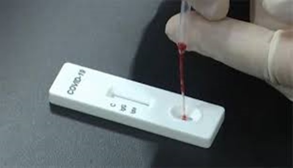 Test yapılınca virüslü hasta sayısı da arttı